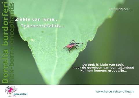 Hersenletsel uitleg.jpg